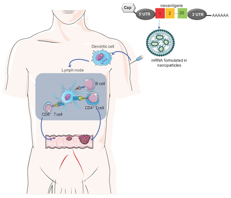 Mechanism of action of mRNA cancer vaccines showing neoantigen delivery, dendritic cell activation, migration to lymph nodes, and T-cell immune response
